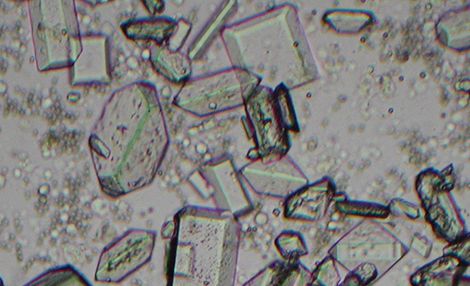 猫のストルバイト結晶の写真