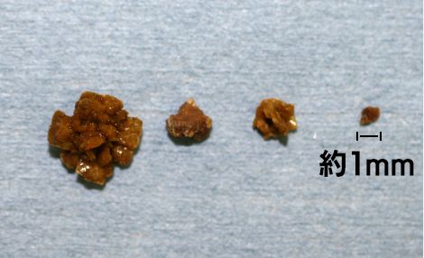 猫のシュウ酸カルシウム結石の写真