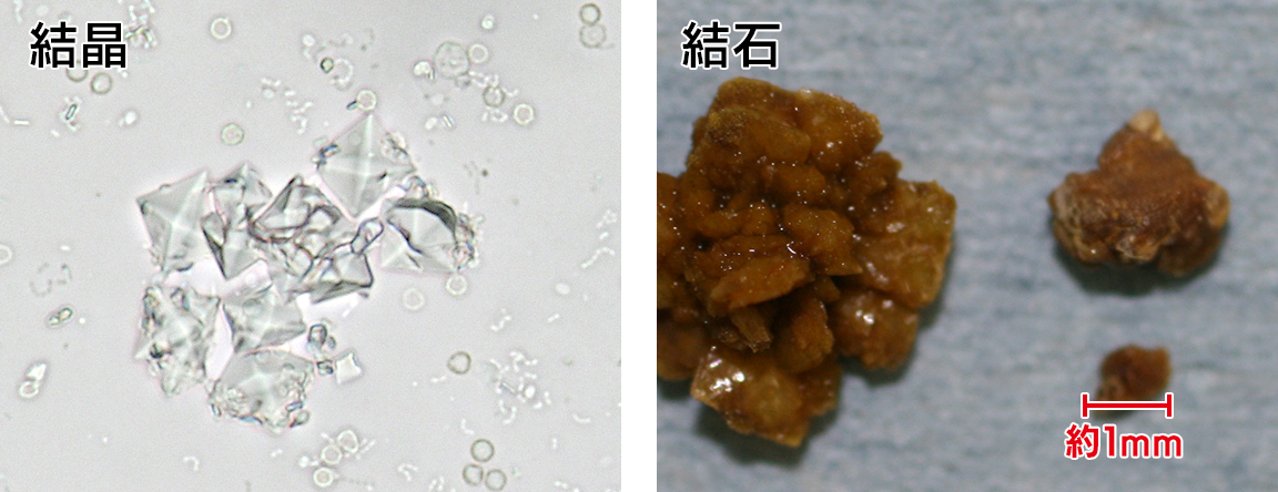 猫のシュウ酸カルシウム結晶・猫のシュウ酸カルシウム結石の写真