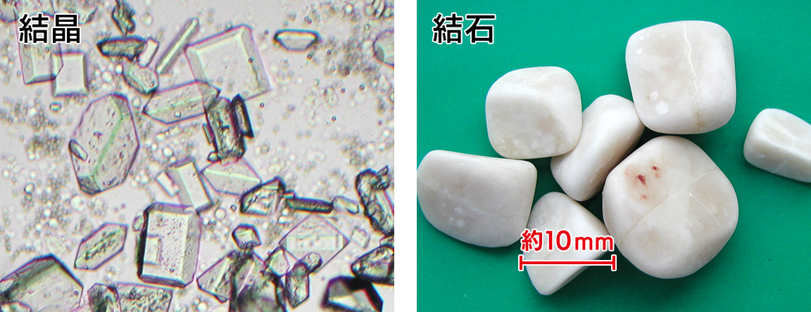 猫のストルバイト結晶・ストルバイト結石の写真