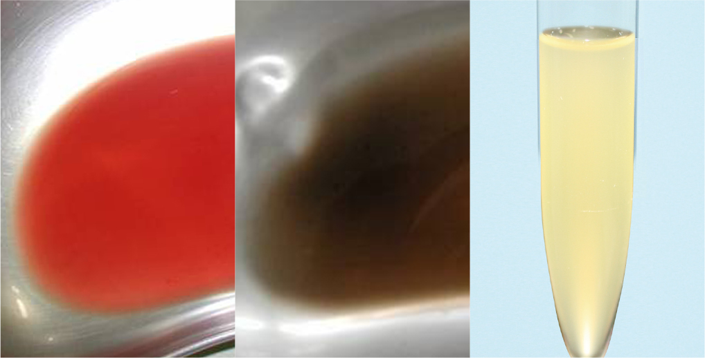 猫のオシッコの注意すべき色の写真