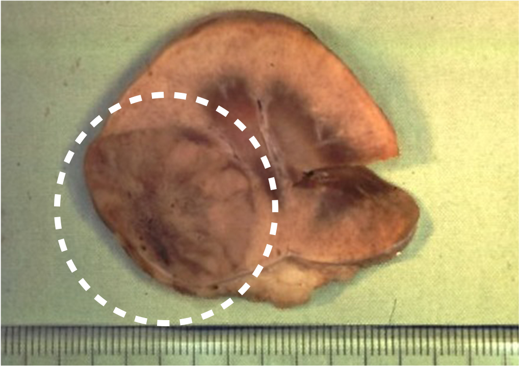 猫の形が変形している腎臓の写真