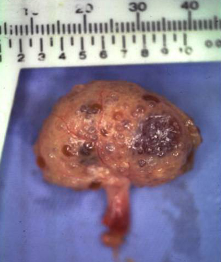 腎不全を起こした猫の腎臓の写真