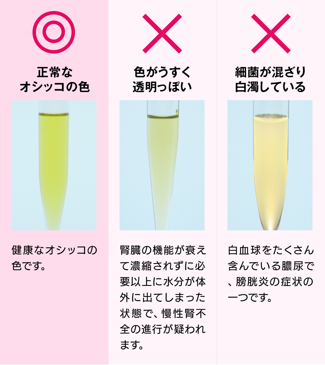 色がうすく透明っぽいオシッコは、腎臓の機能が衰えて濃縮されずに必要以上に水分が体外に出てしまった状態で、慢性腎不全の進行が疑われます。細菌が混ざり白濁しているオシッコは、白血球をたくさん含んでいる膿尿で、膀胱炎の症状の一つです。